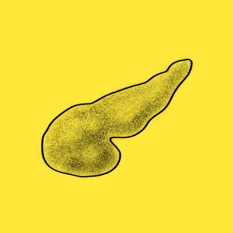 췌장과 대장 건강을 해치는 식습관과 식이섬유의 중요성을 설명하는 woolim의 전문 가이드 일러스트