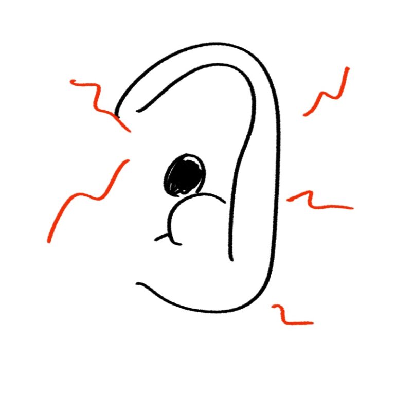 직접 그린 귓바퀴 동증과 귀의 모양