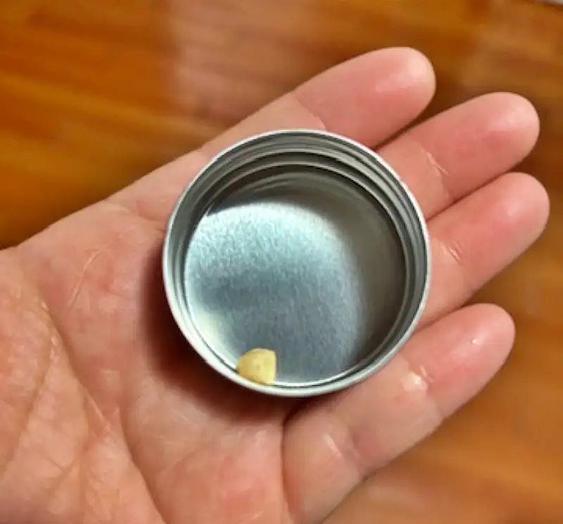 이빨 떼운 거 빠졌을 때 비용 레진 재치료 인레이 탈락 크라운 재부착 가격 응급처치 치과 2026